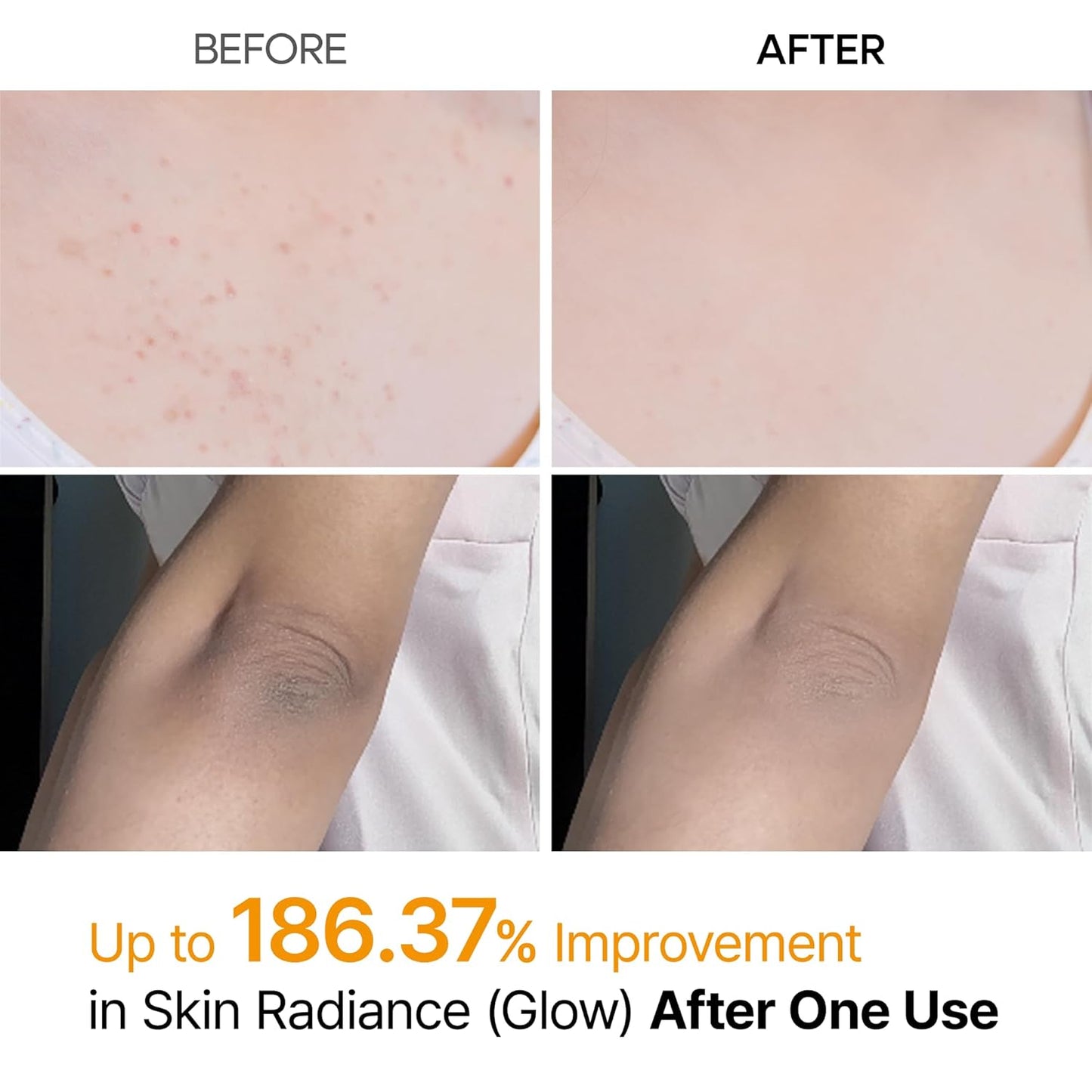 Dr. Melaxin Peel Shot | Korean Body Spray for Dark Spots