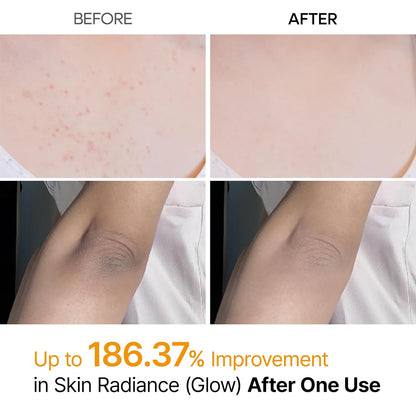 Dr. Melaxin Peel Shot | Korean Body Spray for Dark Spots