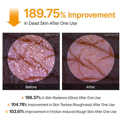 Dr. Melaxin Peel Shot | Korean Body Spray for Dark Spots