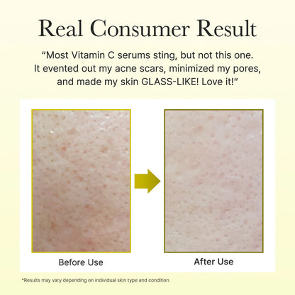 Arencia Vitamin C Booster Shot — Dark Spot & Dull Skin Corrector for Face & Body